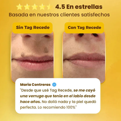 Veneno de Abeja ™  - Elimina Verrugas En 7 Días De Forma Natural y Sin Dolor